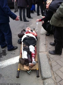 Очевидцы теракта в Минске: на коже раненых было серо-зеленое вещество 