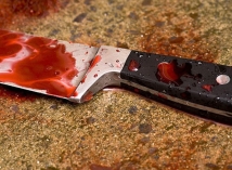 Кавказец в дорожной ссоре пырнул ножом москвича 